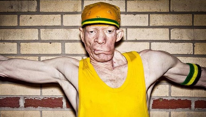 Voice of the Streets: Yellowman's Story, a Gritty Climb from Kingston Orphanage to Global Stage